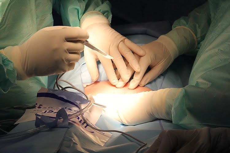 requirements for weight loss surgery
